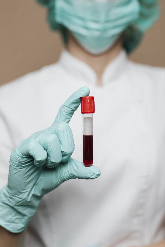 Nurse holding a blood test tube